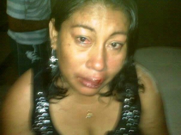 Home Ministry “dismayed” at alleged police beating of Rupununi woman