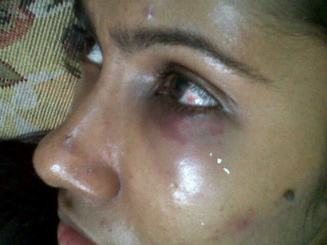 Govt minister’s son allegedly assaults ex-girlfriend