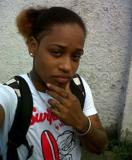 Woman burnt with acid