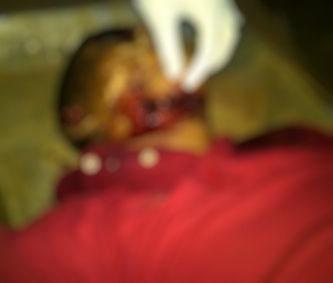 Updated: Man killed on Port Kaituma road identified