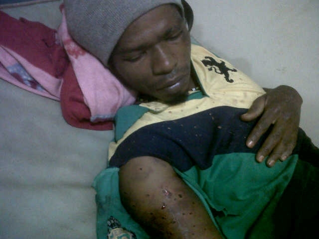 Gold miner shot, robbed