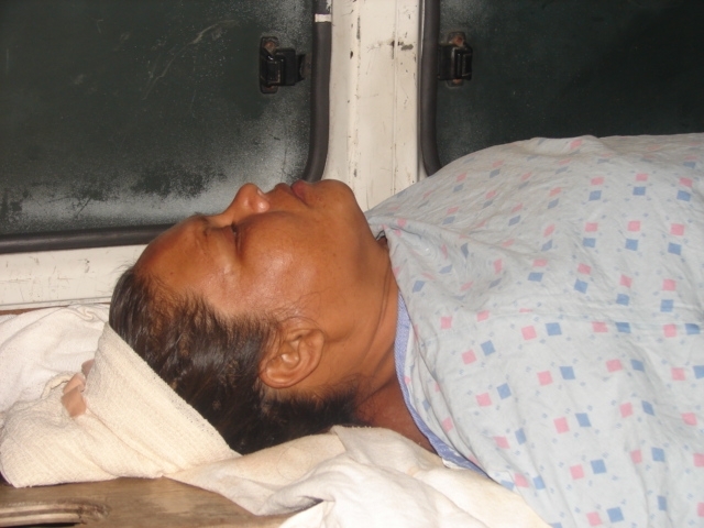 Four injured in Port Kaituma smash-up