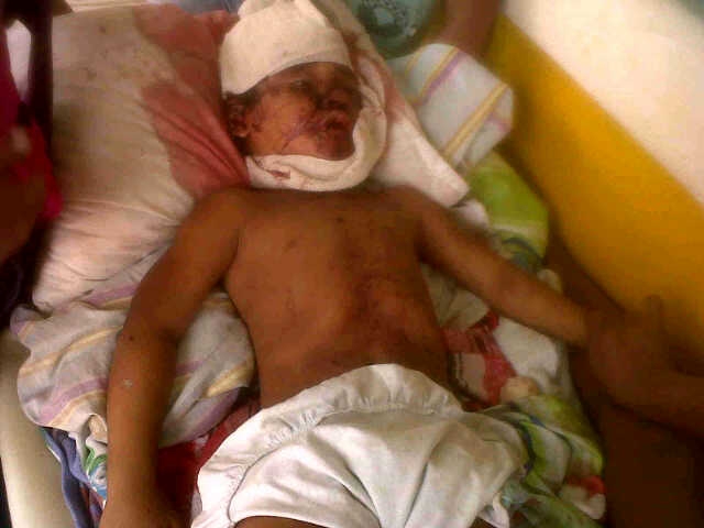 Puma mauls little girl