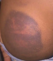 Head teacher allegedly severely beats child over fire crackers