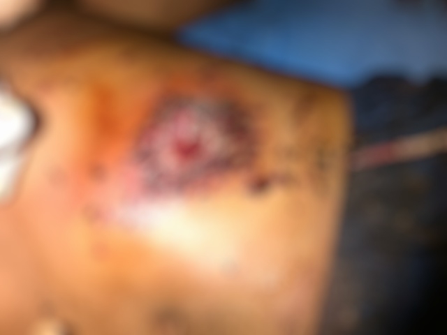 Attempted suicide or attempted murder?