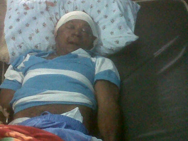 Brazilian beaten to death during robbery