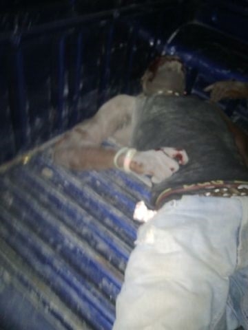 Easter fires continue; two seriously hurt in accidents