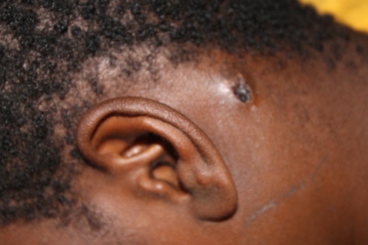 Teen shot in mouth refuses policeman’s $ettlement