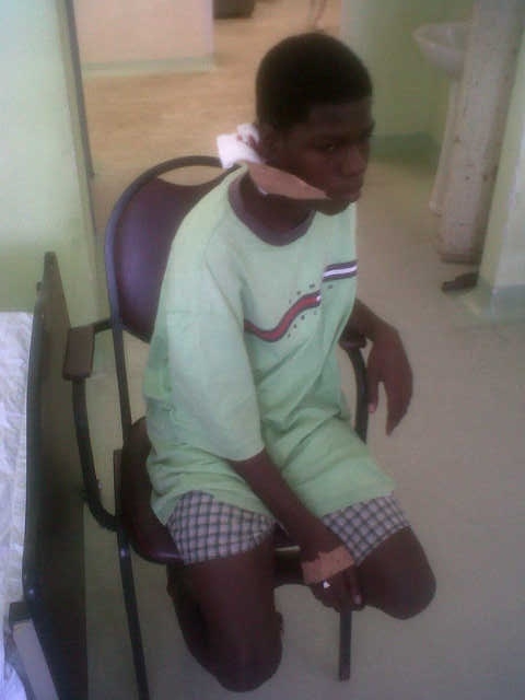 Police shoots boy in mouth