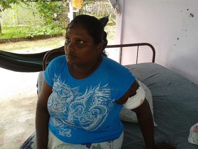 Masked bandits chop Berbice residents, escape with valuables