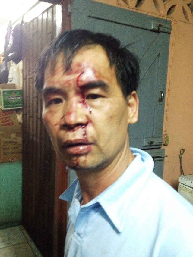 Chinese restaurateur, wife beaten, robbed