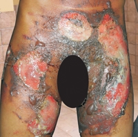 APNU accuses govt of creating environment for torture by security forces