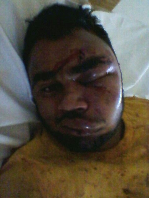 Lethem businessman reportedly beaten by army men