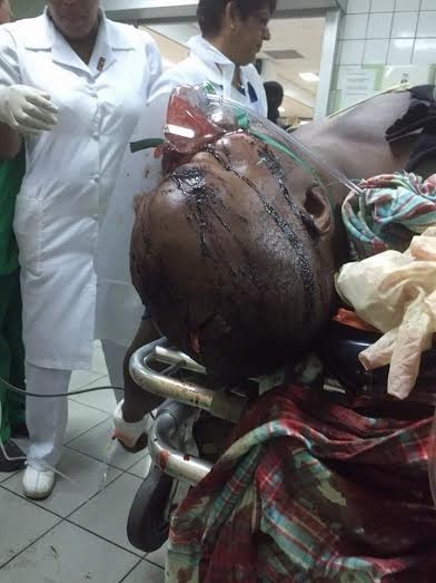 SURINAME: Police kill two bandits, injure three