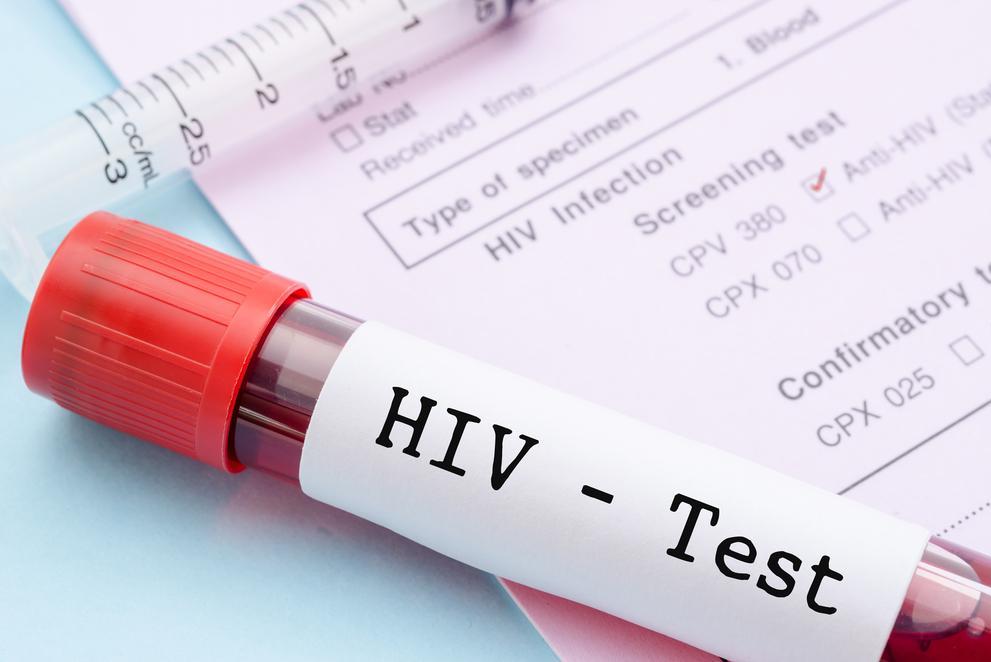 US to help reduce HIV load in 90 percent of infected Guyanese