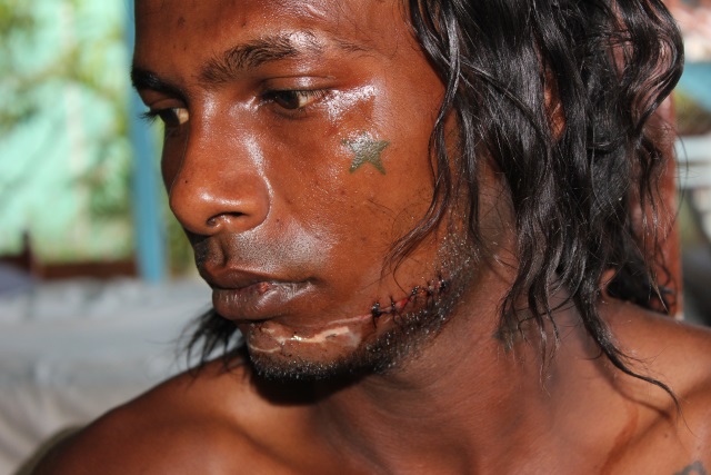 Community policeman, son in custody for wounding over counterfeit money