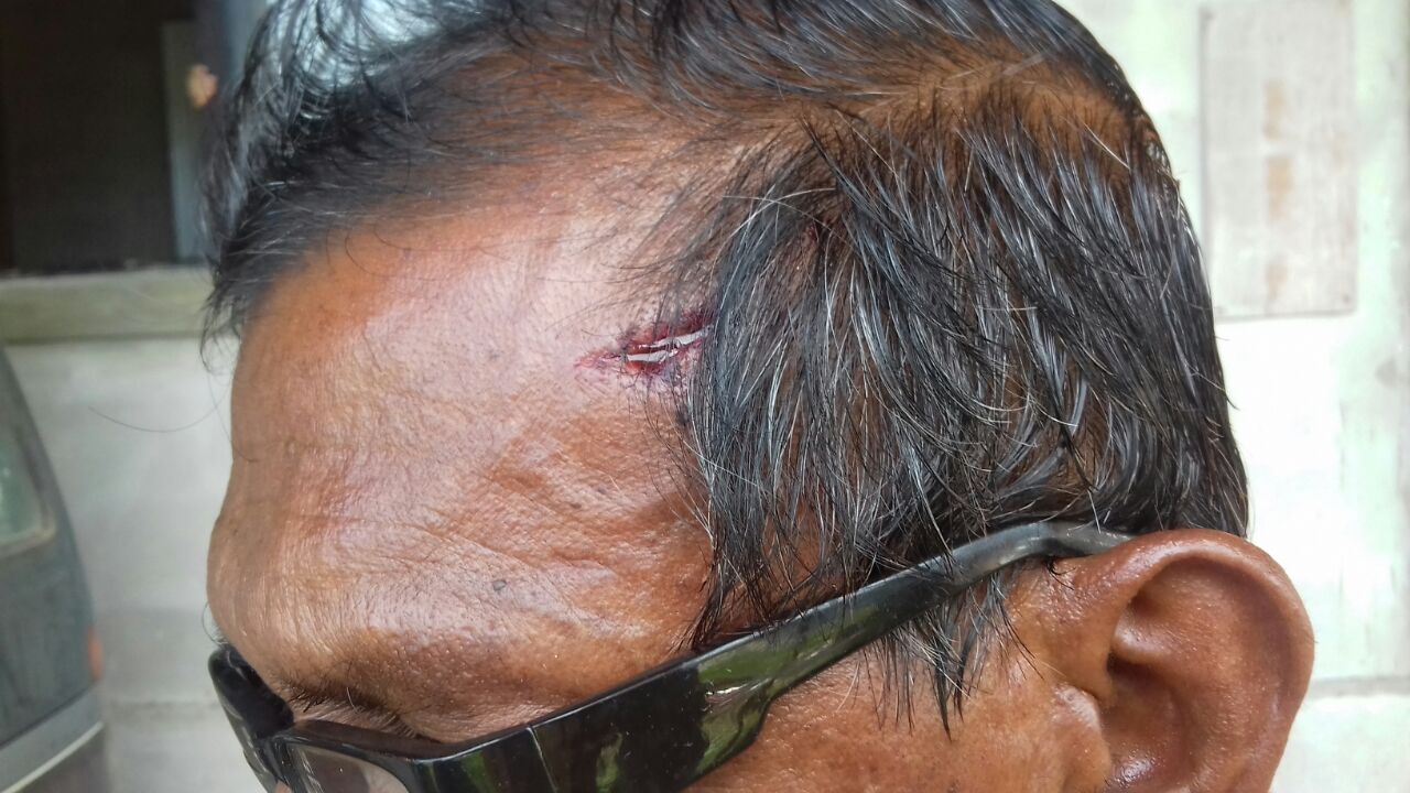 Heavily armed bandits escape with over $1M in cash, valuables from Corentyne bar