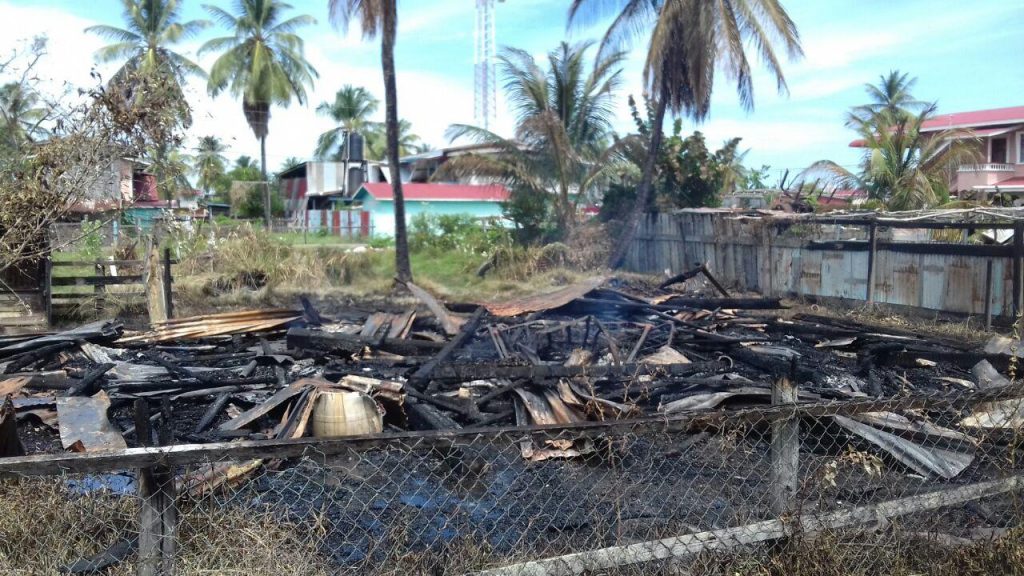 West Coast Berbice man severely burnt in Bushlot mystery fire ...