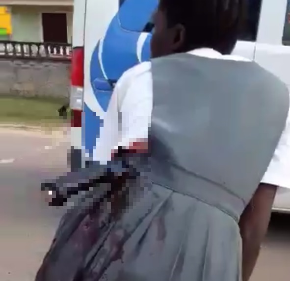 Two students arrested for stabbing of Linden Foundation schoolmate