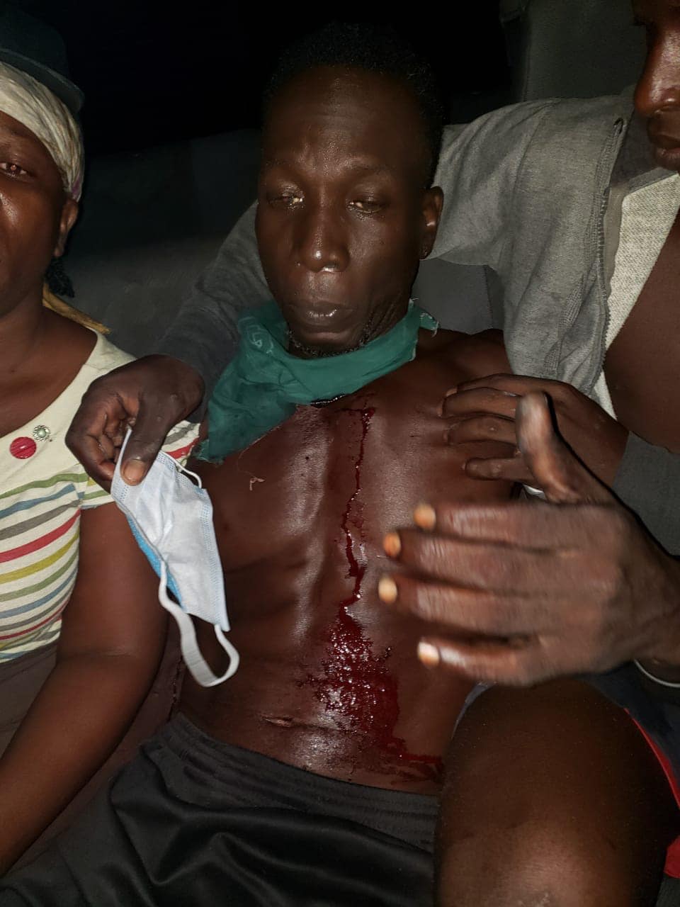 Civilian, police injured during police clearance of Belladrum Public Road; three GECOM officials for court today