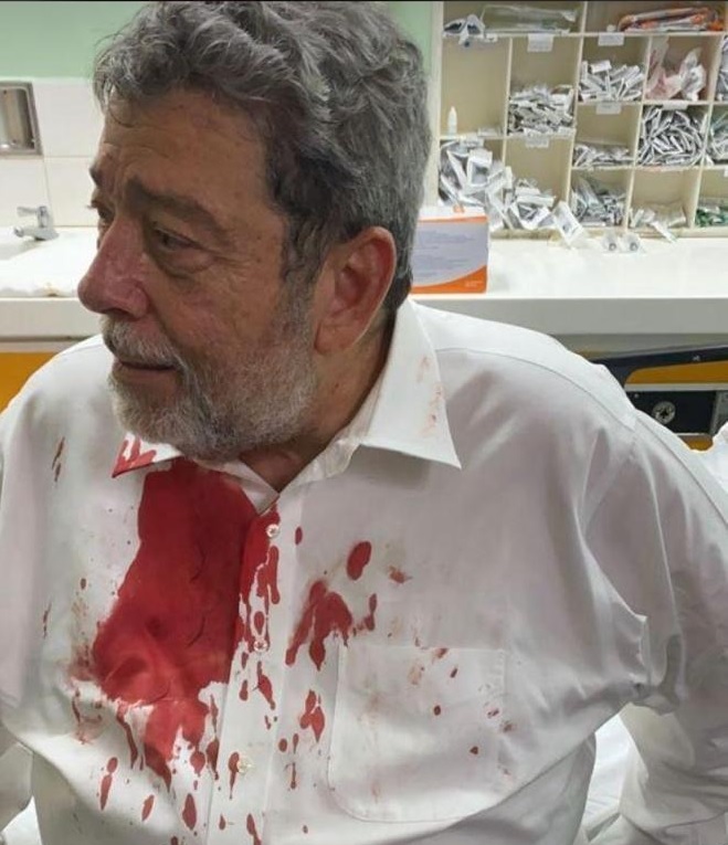 Opposition protesters injure St. Vincent and the Grenadines Prime Minister