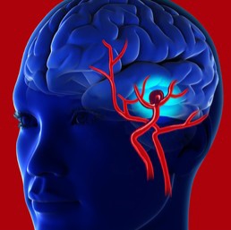 Moruca teen, who died hours after vaccination, had weakened brain artery before