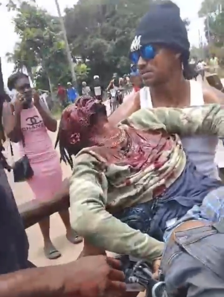 Protester killed in Linden protest against police shooting death of man